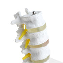 1:1 Human 4 Lumbar Vertebrae Intervertebral Disc Skeleton Model School Teaching Display Lab Supplies