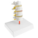 1:1 Human 4 Lumbar Vertebrae Intervertebral Disc Skeleton Model School Teaching Display Lab Supplies