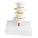 1:1 Human 4 Lumbar Vertebrae Intervertebral Disc Skeleton Model School Teaching Display Lab Supplies