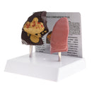Minify 1x Human Lung Normal & Pathological Comparison Lab Demonstration Model Kits Learning Resources