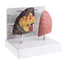 Minify 1x Human Lung Normal & Pathological Comparison Lab Demonstration Model Kits Learning Resources