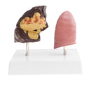 Minify 1x Human Lung Normal & Pathological Comparison Lab Demonstration Model Kits Learning Resources