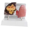 Minify 1x Human Lung Normal & Pathological Comparison Lab Demonstration Model Kits Learning Resources