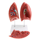 1:1 Lifesize Human Lung Structure Removable 4 Parts Lab Demonstration Model School Teaching Display