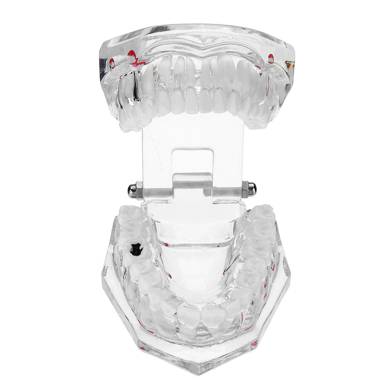 Clear Dental Teeth Study Teaching Model Crystal Typodont Model Removable Teeth Model Medical Model