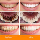 Teeth Whitening Cream Breath Foam Remove Black Yellow Smoke Tea Stains Portable Oral Freshener