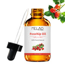 Organic Rosehip Oil 4 oz Skin Care Moisturizer Scar Removal Facial Acne Essential Oil