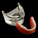 Oral Teeth Study Teach Demonstration Model Overdenture Inferior 2 Implant Demo Teaching Model - Clear Base