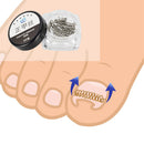 1 Box Toe Nails Wire Corrector Care Tools For Toes Ingrown Toenails,Prevents the Toenail Ingrowing