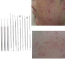 12x Blackhead Needle Acne Blemish Tool Pimple Extractor Removal Skin Care