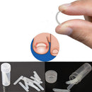 Ingrown Toenail Correction Patch Kit, Professional Toe Nail Care Pedicure Manicure Sticker Fixer Corrector Tool, Paronychia Toenail Pain Relief