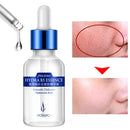 HYDRA B5 ESSENCE Hyaluronic Acid Serum Skin Care Deep Facial Anti Aging Wrinkle