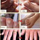 Nail Art Softener Soften Dead Skin Cuticle Remover Cream Manicure Tools Nail Treatment Cream