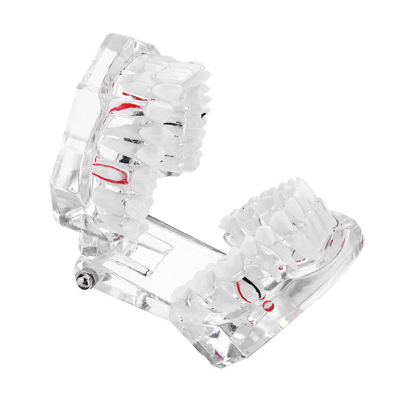 Clear Dental Teeth Study Teaching Model Crystal Typodont Model Removable Teeth Model Medical Model