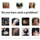 20ml Hair Growth Treatment Hair Loss Spray Hair Essence Oil