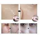 LANBENA Hyaluronic Acid Serum Snail Essence Moisturizing Acne Treatment Repair Anti-Aning Winkles