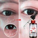 Revitalizing Eye Essence Liquid Fade Dark Circle Eye Bag Remove Fat Granule Essence Face