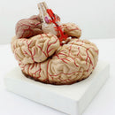 Human Anatomical Brain Epiphysis Dissection Medical Organ Teach Model
