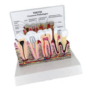 Tooth Pathology Dissection Model Decayed Tooth Gingival Dissection 6.5Ã—5Ã—4 inch High Quality
