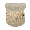 Teeth Orthodontic Model Self-ligating Bracket Straight Edgewise Bracket 90Ã—70Ã—60mm For Teaching Education