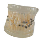 Teeth Orthodontic Model Self-ligating Bracket Straight Edgewise Bracket 90Ã—70Ã—60mm For Teaching Education