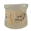 Teeth Orthodontic Model Self-ligating Bracket Straight Edgewise Bracket 90Ã—70Ã—60mm For Teaching Education