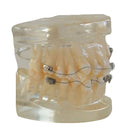 Teeth Orthodontic Model Self-ligating Bracket Straight Edgewise Bracket 90Ã—70Ã—60mm For Teaching Education