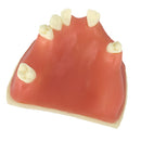 Upper Jaw Sinus Lift Implants Restoration Tooth Practice Model Dental Mold 2.36Ã—2.36Ã—1.57 inch