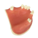 Upper Jaw Sinus Lift Implants Restoration Tooth Practice Model Dental Mold 2.36Ã—2.36Ã—1.57 inch