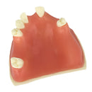 Upper Jaw Sinus Lift Implants Restoration Tooth Practice Model Dental Mold 2.36Ã—2.36Ã—1.57 inch