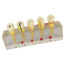 Teeth Pulp Disease Clinical Model for Teeth Teaching Learning