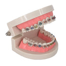 Typodont Demonstration Teeth Model Orthodontic Tooth Model with Bracket