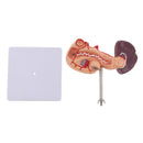 Premium Life Size Anatomical Pancreas, Duodenum, Spleen Model With Base - Human Anatomy