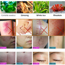 30g Acne Scar Removal Cream Skin Repair Cream Cream