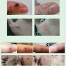 8ml Warts Foot Corn Removal Ointment Plaster Chinese Medical Treatment Plantar Warts Treatment Foot Care Plaster Cream