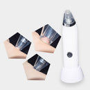 Electric Absorbing Blackhead Pore Cleanser Skin Care Acne Suction Remover Facial Care Device Tool