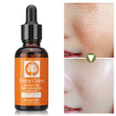 30ml Vitamin C Skin Ultra Moisturize Brightening Spotless Essential Oil Anti Dark Spots