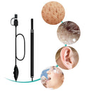 Y.F.M3 In 1 Ear Cleaning Endo-Scope HD Visual Ear Spoon Multifunctional Earpick Ear Care Health
