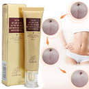 30g Acne Scar Removal Cream Skin Repair Cream Cream