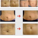 Women Smooth Skin Cream Scar Removal Skin Body Stretch Mark Repair Cream Beauty Care