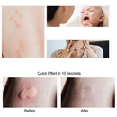 KCASA KC Mosquito Bites Anti-itching Household Dispeller Harmless Mosquito Repeller