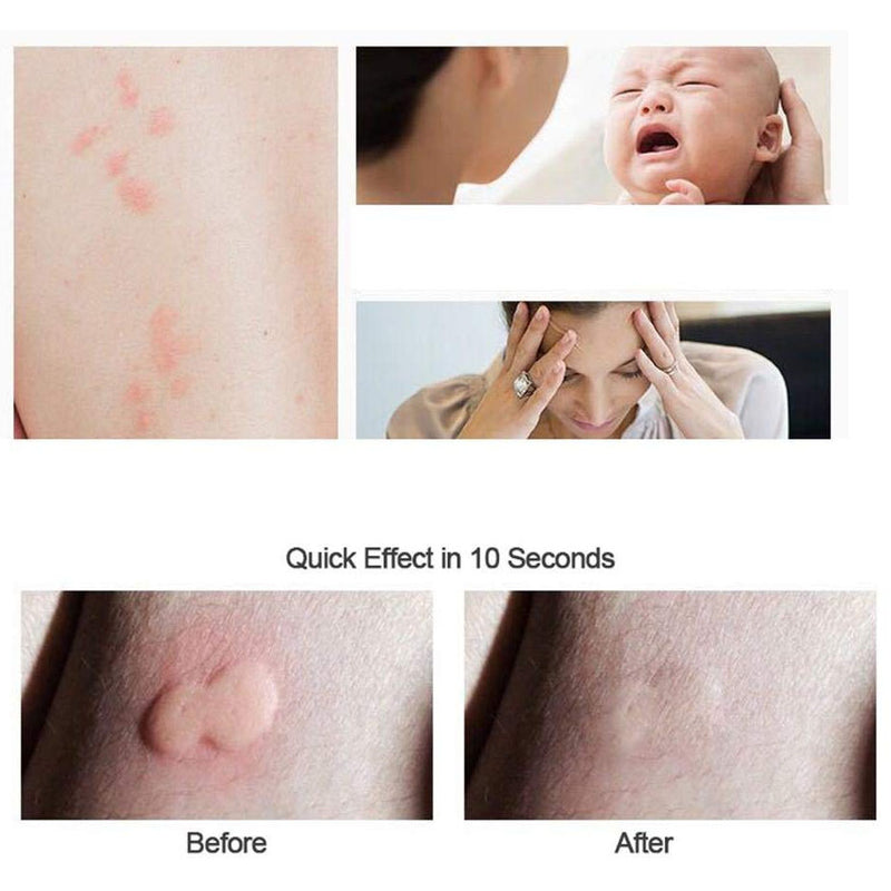 KCASA KC Mosquito Bites Anti-itching Household Dispeller Harmless Mosquito Repeller