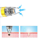 Electric Blackhead Suction Remover 2 Gears Vacuum Acne Pore Cleaner USB Charging Face Nose Skin Care with 3 Heads