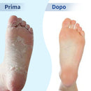 Skymore Foot Peel Mask Exfoliating Callus Peeling Off Calluses & Dead Skin