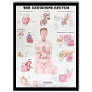 60x80cm The Endocrine System Poster Anatomical Chart Woman Body Educational Medical