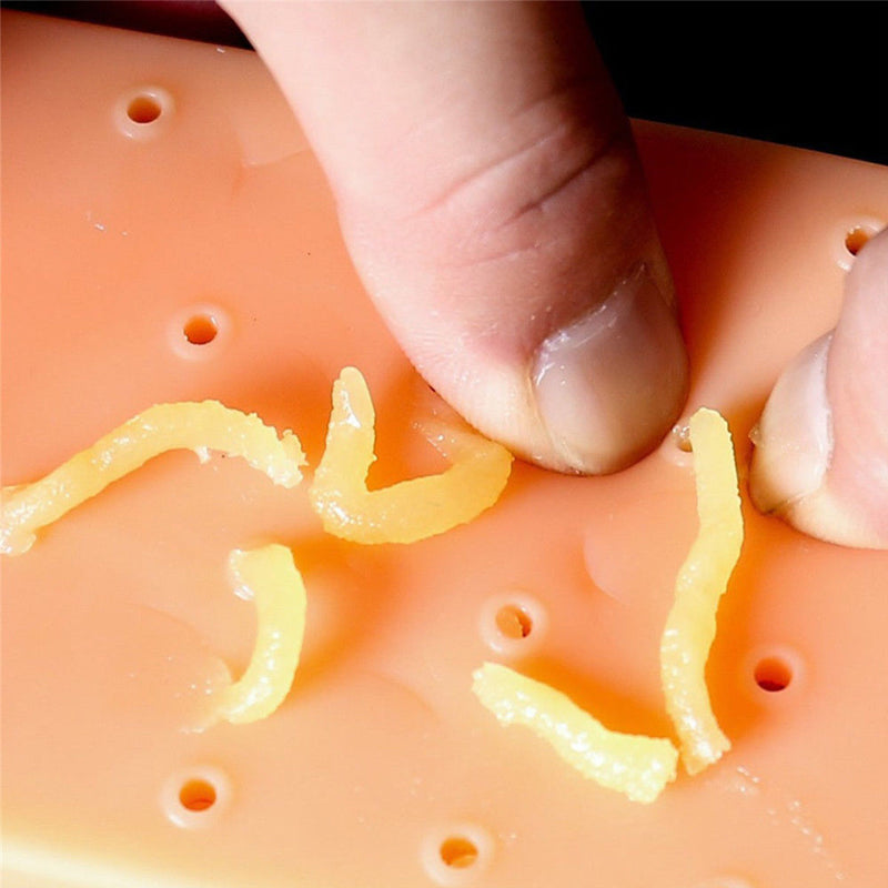 Unique Squeeze Acne Toys Pimple Kit Funny-Toy Pop It Pal Remover Zit Decompression Stress Tool