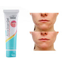35ml Aloe Acne Scar Removal Cream Gel Skin Care Repair Comedo Pimple Face Gel