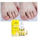 OEDM Nail Treatment Onychomycosis Paronychia Anti Fungal Nail Infection Toe Nail Fungus Treatment