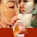 Higo Blackhead Acne Deep Cleansing And Tearing Mask