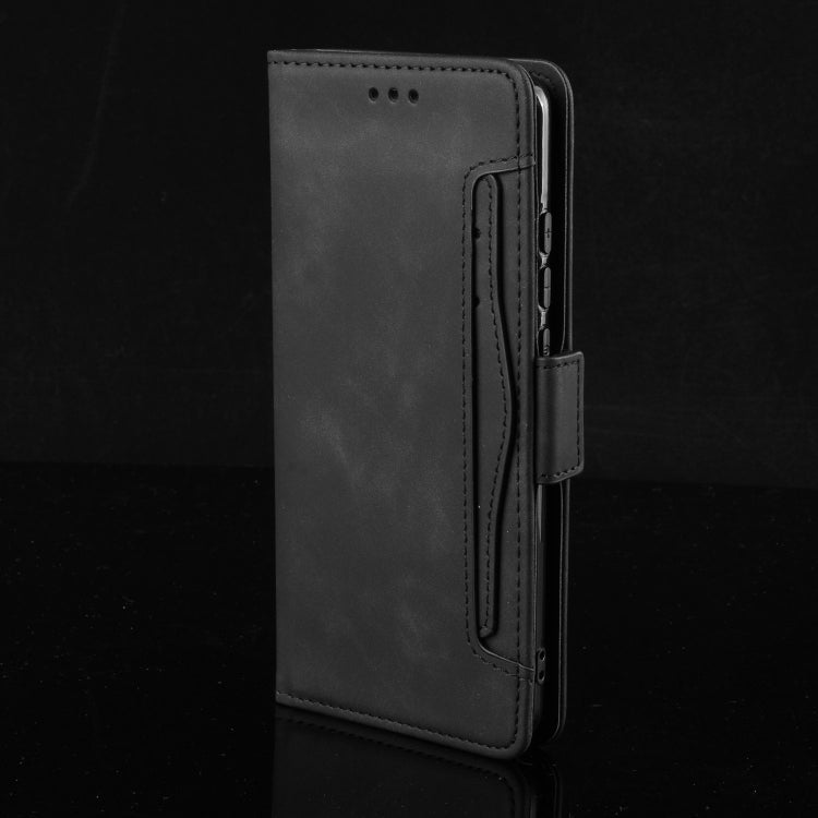 For UMIDIGI Bison Wallet Style Skin Feel Calf Pattern Leather Case with Separate Card Slot(Black)